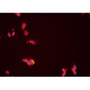 Western blot analysis of extracts from rat brain, using PRMT5 Antibody. Lane 1 was treated with the antigen-specific peptide.