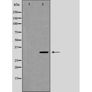 DF6443 at 1/200 staining human heart tissue sections by IHC-P. The tissue was formaldehyde fixed and a heat mediated antigen retrieval step in citrate buffer was performed. The tissue was then blocked and incubated with the antibody for 1.5 hours at 22¡ãC. An HRP conjugated goat anti-rabbit antibody was used as the secondary