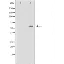 DF6444 at 1/100 staining Rat spleen tissue by IHC-P. The sample was formaldehyde fixed and a heat mediated antigen retrieval step in citrate buffer was performed. The sample was then blocked and incubated with the antibody for 1.5 hours at 22¡ãC. An HRP conjugated goat anti-rabbit antibody was used as the secondary