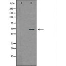 DF6445 at 1/100 staining Mouse brain tissue by IHC-P. The sample was formaldehyde fixed and a heat mediated antigen retrieval step in citrate buffer was performed. The sample was then blocked and incubated with the antibody for 1.5 hours at 22¡ãC. An HRP conjugated goat anti-rabbit antibody was used as the secondary