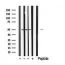 DF6447 at 1/100 staining Human pancreas tissue by IHC-P. The sample was formaldehyde fixed and a heat mediated antigen retrieval step in citrate buffer was performed. The sample was then blocked and incubated with the antibody for 1.5 hours at 22¡ãC. An HRP conjugated goat anti-rabbit antibody was used as the secondary