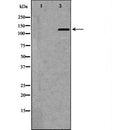 DF6450 at 1/100 staining Mouse liver tissue by IHC-P. The sample was formaldehyde fixed and a heat mediated antigen retrieval step in citrate buffer was performed. The sample was then blocked and incubated with the antibody for 1.5 hours at 22¡ãC. An HRP conjugated goat anti-rabbit antibody was used as the secondary