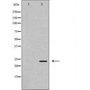 DF6454 at 1/100 staining Human Melanoma tissue by IHC-P. The sample was formaldehyde fixed and a heat mediated antigen retrieval step in citrate buffer was performed. The sample was then blocked and incubated with the antibody for 1.5 hours at 22¡ãC. An HRP conjugated goat anti-rabbit antibody was used as the secondary
