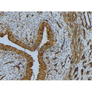 Western blot analysis of extracts from 293, using B2M Antibody. Lane 1 was treated with the antigen-specific peptide.
