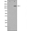 DF6469 at 1/100 staining Human melanoma tissue by IHC-P. The sample was formaldehyde fixed and a heat mediated antigen retrieval step in citrate buffer was performed. The sample was then blocked and incubated with the antibody for 1.5 hours at 22¡ãC. An HRP conjugated goat anti-rabbit antibody was used as the secondary