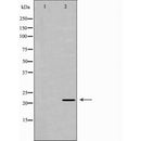 DF6471 at 1/100 staining Human uterus tissue by IHC-P. The sample was formaldehyde fixed and a heat mediated antigen retrieval step in citrate buffer was performed. The sample was then blocked and incubated with the antibody for 1.5 hours at 22¡ãC. An HRP conjugated goat anti-rabbit antibody was used as the secondary