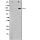 DF6473 at 1/100 staining Mouse brain tissue by IHC-P. The sample was formaldehyde fixed and a heat mediated antigen retrieval step in citrate buffer was performed. The sample was then blocked and incubated with the antibody for 1.5 hours at 22¡ãC. An HRP conjugated goat anti-rabbit antibody was used as the secondary