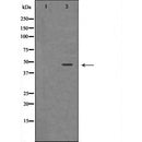 DF6480 at 1/100 staining Human uterus tissue by IHC-P. The sample was formaldehyde fixed and a heat mediated antigen retrieval step in citrate buffer was performed. The sample was then blocked and incubated with the antibody for 1.5 hours at 22¡ãC. An HRP conjugated goat anti-rabbit antibody was used as the secondary