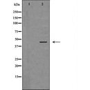 DF6484 at 1/100 staining Mouse testis tissue by IHC-P. The sample was formaldehyde fixed and a heat mediated antigen retrieval step in citrate buffer was performed. The sample was then blocked and incubated with the antibody for 1.5 hours at 22¡ãC. An HRP conjugated goat anti-rabbit antibody was used as the secondary