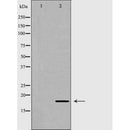 DF6485 at 1/100 staining Mouse testis tissue by IHC-P. The sample was formaldehyde fixed and a heat mediated antigen retrieval step in citrate buffer was performed. The sample was then blocked and incubated with the antibody for 1.5 hours at 22¡ãC. An HRP conjugated goat anti-rabbit antibody was used as the secondary