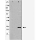 DF6491 at 1/100 staining Human melanoma tissue by IHC-P. The sample was formaldehyde fixed and a heat mediated antigen retrieval step in citrate buffer was performed. The sample was then blocked and incubated with the antibody for 1.5 hours at 22¡ãC. An HRP conjugated goat anti-rabbit antibody was used as the secondary