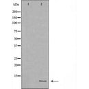 DF6492 at 1/100 staining Mouse liver tissue by IHC-P. The sample was formaldehyde fixed and a heat mediated antigen retrieval step in citrate buffer was performed. The sample was then blocked and incubated with the antibody for 1.5 hours at 22¡ãC. An HRP conjugated goat anti-rabbit antibody was used as the secondary