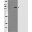 DF6493 staining Hela by IF/ICC. The sample were fixed with PFA and permeabilized in 0.1% Triton X-100,then blocked in 10% serum for 45 minutes at 25¡ãC. The primary antibody was diluted at 1/200 and incubated with the sample for 1 hour at 37¡ãC. An  Alexa Fluor 594 conjugated goat anti-rabbit IgG (H+L) Ab, diluted at 1/600, was used as the secondary antibod