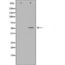 DF6494 at 1/100 staining Human Melanoma tissue by IHC-P. The sample was formaldehyde fixed and a heat mediated antigen retrieval step in citrate buffer was performed. The sample was then blocked and incubated with the antibody for 1.5 hours at 22¡ãC. An HRP conjugated goat anti-rabbit antibody was used as the secondary