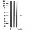 DF6503 at 1/100 staining Human Melanoma tissue by IHC-P. The sample was formaldehyde fixed and a heat mediated antigen retrieval step in citrate buffer was performed. The sample was then blocked and incubated with the antibody for 1.5 hours at 22¡ãC. An HRP conjugated goat anti-rabbit antibody was used as the secondary