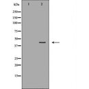 DF6504 at 1/100 staining Rat lung tissue by IHC-P. The sample was formaldehyde fixed and a heat mediated antigen retrieval step in citrate buffer was performed. The sample was then blocked and incubated with the antibody for 1.5 hours at 22¡ãC. An HRP conjugated goat anti-rabbit antibody was used as the secondary