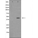 DF6509 at 1/100 staining Human lymph tissue by IHC-P. The sample was formaldehyde fixed and a heat mediated antigen retrieval step in citrate buffer was performed. The sample was then blocked and incubated with the antibody for 1.5 hours at 22¡ãC. An HRP conjugated goat anti-rabbit antibody was used as the secondary