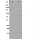 DF6510 at 1/100 staining Human breast cancer tissue by IHC-P. The sample was formaldehyde fixed and a heat mediated antigen retrieval step in citrate buffer was performed. The sample was then blocked and incubated with the antibody for 1.5 hours at 22¡ãC. An HRP conjugated goat anti-rabbit antibody was used as the secondary