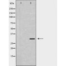 DF6513 at 1/100 staining Mouse kidney tissue by IHC-P. The sample was formaldehyde fixed and a heat mediated antigen retrieval step in citrate buffer was performed. The sample was then blocked and incubated with the antibody for 1.5 hours at 22¡ãC. An HRP conjugated goat anti-rabbit antibody was used as the secondary