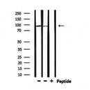DF6518 at 1/100 staining Human gastric tissue by IHC-P. The sample was formaldehyde fixed and a heat mediated antigen retrieval step in citrate buffer was performed. The sample was then blocked and incubated with the antibody for 1.5 hours at 22¡ãC. An HRP conjugated goat anti-rabbit antibody was used as the secondary