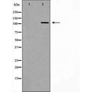 DF6519 at 1/100 staining Mouse placenta tissue by IHC-P. The sample was formaldehyde fixed and a heat mediated antigen retrieval step in citrate buffer was performed. The sample was then blocked and incubated with the antibody for 1.5 hours at 22¡ãC. An HRP conjugated goat anti-rabbit antibody was used as the secondary