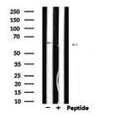 DF6520 at 1/100 staining Human liver cancer tissue by IHC-P. The sample was formaldehyde fixed and a heat mediated antigen retrieval step in citrate buffer was performed. The sample was then blocked and incubated with the antibody for 1.5 hours at 22¡ãC. An HRP conjugated goat anti-rabbit antibody was used as the secondary