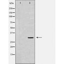 DF6522 at 1/100 staining Human lung tissue by IHC-P. The sample was formaldehyde fixed and a heat mediated antigen retrieval step in citrate buffer was performed. The sample was then blocked and incubated with the antibody for 1.5 hours at 22¡ãC. An HRP conjugated goat anti-rabbit antibody was used as the secondary
