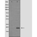 DF6523 at 1/100 staining Mouse testis tissue by IHC-P. The sample was formaldehyde fixed and a heat mediated antigen retrieval step in citrate buffer was performed. The sample was then blocked and incubated with the antibody for 1.5 hours at 22¡ãC. An HRP conjugated goat anti-rabbit antibody was used as the secondary