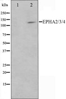 Western blot analysis on HepG2 cell lysate using EPHA2/3/4 Antibody,The lane on the left is treated with the antigen-specific peptide.