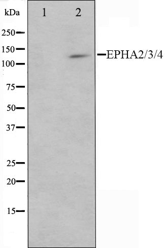 Western blot analysis on HepG2 cell lysate using EPHA2/3/4 Antibody,The lane on the left is treated with the antigen-specific peptide.