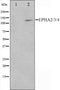 Western blot analysis on HepG2 cell lysate using EPHA2/3/4 Antibody,The lane on the left is treated with the antigen-specific peptide.
