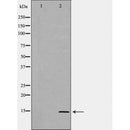 DF6533 at 1/100 staining Mouse liver tissue by IHC-P. The sample was formaldehyde fixed and a heat mediated antigen retrieval step in citrate buffer was performed. The sample was then blocked and incubated with the antibody for 1.5 hours at 22¡ãC. An HRP conjugated goat anti-rabbit antibody was used as the secondary
