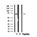 DF6534 at 1/100 staining Mouse liver tissue by IHC-P. The sample was formaldehyde fixed and a heat mediated antigen retrieval step in citrate buffer was performed. The sample was then blocked and incubated with the antibody for 1.5 hours at 22¡ãC. An HRP conjugated goat anti-rabbit antibody was used as the secondary