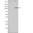 DF6536 at 1/100 staining Human Head and neck cancer tissue by IHC-P. The sample was formaldehyde fixed and a heat mediated antigen retrieval step in citrate buffer was performed. The sample was then blocked and incubated with the antibody for 1.5 hours at 22¡ãC. An HRP conjugated goat anti-rabbit antibody was used as the secondary