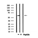 DF6537 at 1/100 staining Mouse liver tissue by IHC-P. The sample was formaldehyde fixed and a heat mediated antigen retrieval step in citrate buffer was performed. The sample was then blocked and incubated with the antibody for 1.5 hours at 22¡ãC. An HRP conjugated goat anti-rabbit antibody was used as the secondary