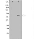 DF6540 at 1/100 staining Mouse liver tissue by IHC-P. The sample was formaldehyde fixed and a heat mediated antigen retrieval step in citrate buffer was performed. The sample was then blocked and incubated with the antibody for 1.5 hours at 22¡ãC. An HRP conjugated goat anti-rabbit antibody was used as the secondary