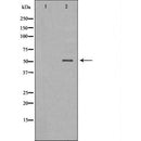 DF6542 at 1/100 staining Human melanoma tissue by IHC-P. The sample was formaldehyde fixed and a heat mediated antigen retrieval step in citrate buffer was performed. The sample was then blocked and incubated with the antibody for 1.5 hours at 22¡ãC. An HRP conjugated goat anti-rabbit antibody was used as the secondary
