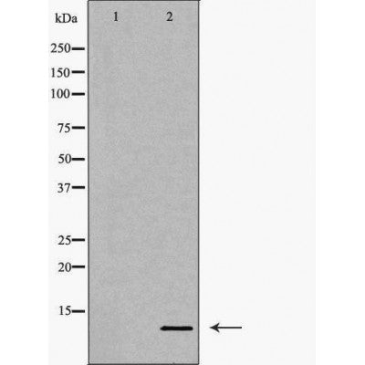 DF6545 at 1/100 staining Human Melanoma tissue by IHC-P. The sample was formaldehyde fixed and a heat mediated antigen retrieval step in citrate buffer was performed. The sample was then blocked and incubated with the antibody for 1.5 hours at 22¡ãC. An HRP conjugated goat anti-rabbit antibody was used as the secondary