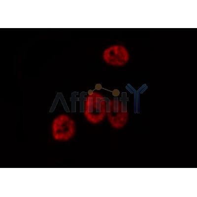 DF6548 at 1/100 staining Mouse brain tissue by IHC-P. The sample was formaldehyde fixed and a heat mediated antigen retrieval step in citrate buffer was performed. The sample was then blocked and incubated with the antibody for 1.5 hours at 22¡ãC. An HRP conjugated goat anti-rabbit antibody was used as the secondary