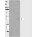 DF6550 at 1/100 staining Human gastric tissue by IHC-P. The sample was formaldehyde fixed and a heat mediated antigen retrieval step in citrate buffer was performed. The sample was then blocked and incubated with the antibody for 1.5 hours at 22¡ãC. An HRP conjugated goat anti-rabbit antibody was used as the secondary