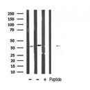 DF6552 at 1/100 staining Mouse brain tissue by IHC-P. The sample was formaldehyde fixed and a heat mediated antigen retrieval step in citrate buffer was performed. The sample was then blocked and incubated with the antibody for 1.5 hours at 22¡ãC. An HRP conjugated goat anti-rabbit antibody was used as the secondary