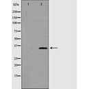 DF6554 at 1/100 staining Mouse brain tissue by IHC-P. The sample was formaldehyde fixed and a heat mediated antigen retrieval step in citrate buffer was performed. The sample was then blocked and incubated with the antibody for 1.5 hours at 22¡ãC. An HRP conjugated goat anti-rabbit antibody was used as the secondary