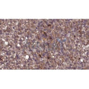 Western blot analysis of extracts from Mouse  liver, using KIR2DL3 Antibody. The lane on the left was treated with blocking peptide.