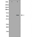 DF6564 at 1/100 staining Human urothelial cancer tissue by IHC-P. The sample was formaldehyde fixed and a heat mediated antigen retrieval step in citrate buffer was performed. The sample was then blocked and incubated with the antibody for 1.5 hours at 22¡ãC. An HRP conjugated goat anti-rabbit antibody was used as the secondary