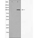 DF6566 at 1/100 staining Mouse liver tissue by IHC-P. The sample was formaldehyde fixed and a heat mediated antigen retrieval step in citrate buffer was performed. The sample was then blocked and incubated with the antibody for 1.5 hours at 22¡ãC. An HRP conjugated goat anti-rabbit antibody was used as the secondary