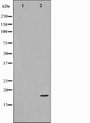 AF0620 staining Hela by IF/ICC. The sample were fixed with PFA and permeabilized in 0.1% Triton X-100,then blocked in 10% serum for 45 minutes at 25¡ãC. The primary antibody was diluted at 1/200 and incubated with the sample for 1 hour at 37¡ãC. An  Alexa Fluor 594 conjugated goat anti-rabbit IgG (H+L) Ab, diluted at 1/600, was used as the secondary antibod