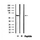 Western blot analysis of extracts from rat muscle, using IFNAR1 Antibody.
