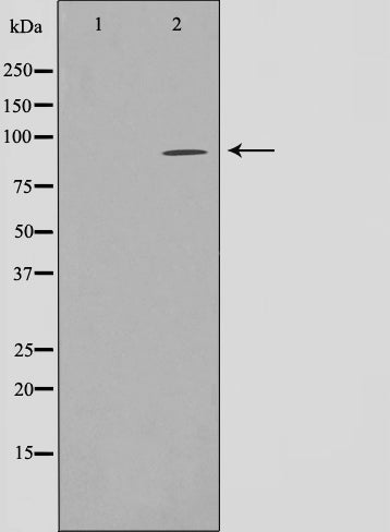 Western blot analysis on HuvEc cell lysate using NADAP Antibody,The lane on the left is treated with the antigen-specific peptide.