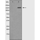 DF6578 staining HepG2 by IF/ICC. The sample were fixed with PFA and permeabilized in 0.1% Triton X-100,then blocked in 10% serum for 45 minutes at 25¡ãC. The primary antibody was diluted at 1/200 and incubated with the sample for 1 hour at 37¡ãC. An  Alexa Fluor 594 conjugated goat anti-rabbit IgG (H+L) Ab, diluted at 1/600, was used as the secondary antibod