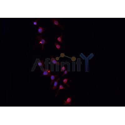 DF6579 at 1/100 staining Mouse colon tissue by IHC-P. The sample was formaldehyde fixed and a heat mediated antigen retrieval step in citrate buffer was performed. The sample was then blocked and incubated with the antibody for 1.5 hours at 22¡ãC. An HRP conjugated goat anti-rabbit antibody was used as the secondary